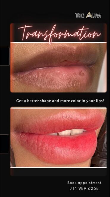 Neutralize Dark Lips with Lip Tattooing 2
