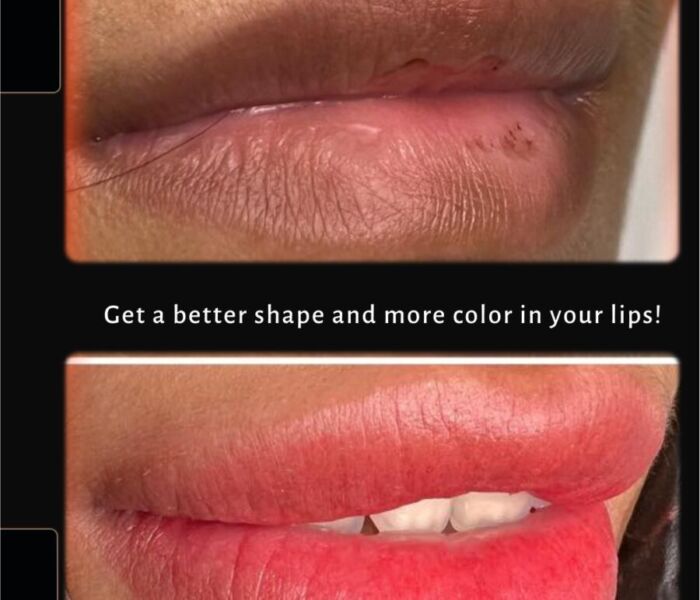 Neutralize Dark Lips with Lip Tattooing 3