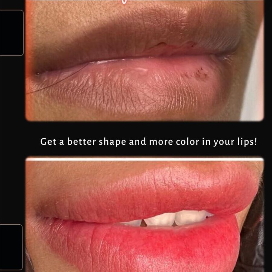 Neutralize Dark Lips with Lip Tattooing 1