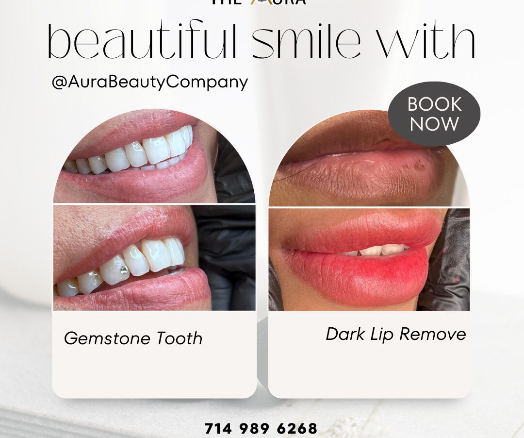 Make your smile shine with Gemstone and Lip Tattoo 1