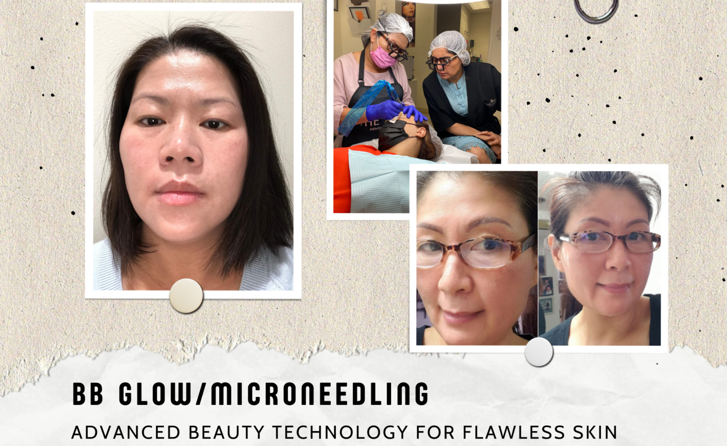 Discover BB Glow/Microneedling - a breakthrough beauty treatment that improves your skin naturally and permanently. BB Glow/Microneedling is a semi-permanent makeup procedure that helps conceal dark spots and naturally even skin tone, stimulate skin regeneration, and reduce crow's feet and wrinkles.