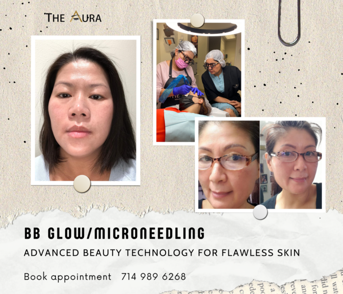 Discover BB Glow/Microneedling - a breakthrough beauty treatment that improves your skin naturally and permanently. BB Glow/Microneedling is a semi-permanent makeup procedure that helps conceal dark spots and naturally even skin tone, stimulate skin regeneration, and reduce crow's feet and wrinkles.